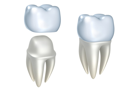 dental implant clinic tijuana