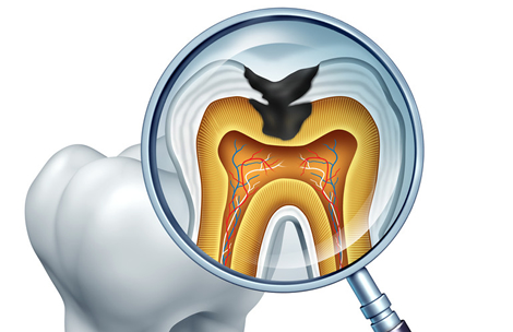 dental implant clinic tijuana